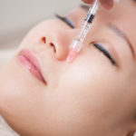 ヒアルロン酸注入