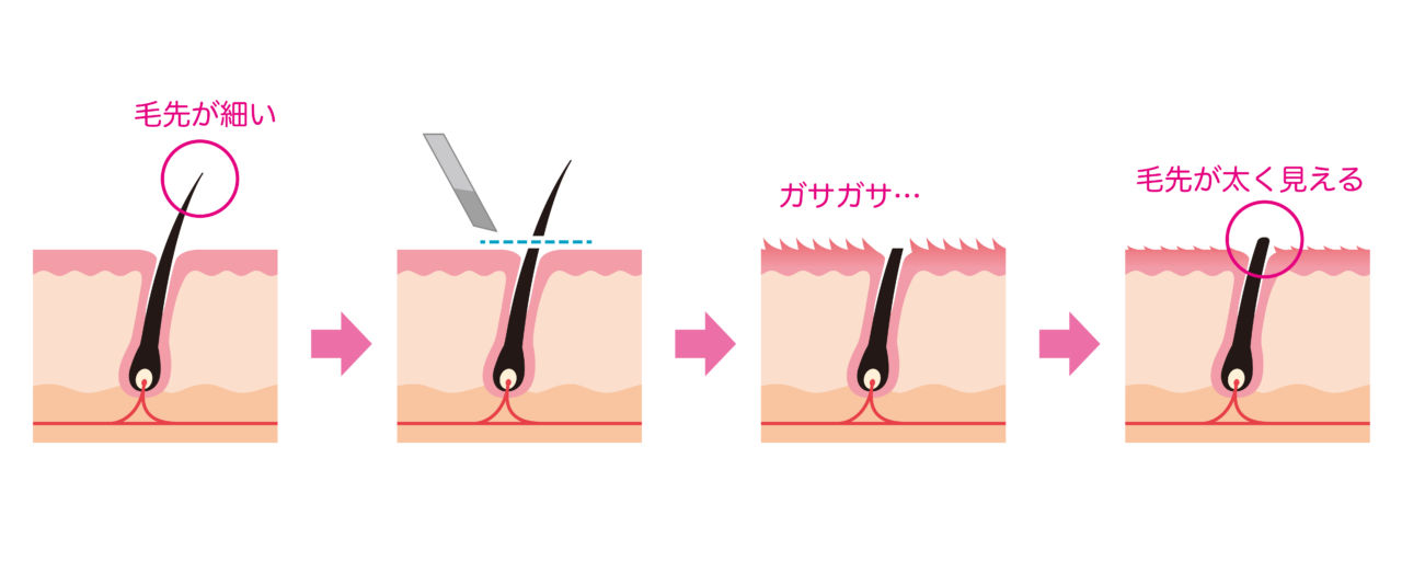 ムダ毛の自己処理