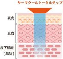 トータルチップの加熱範囲