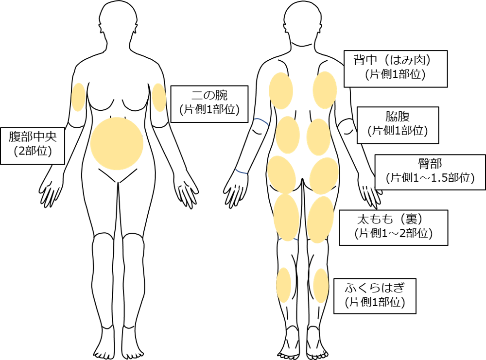 RF痩身タイトニング_ヴィーナスヴェルサ_エルクリニック
