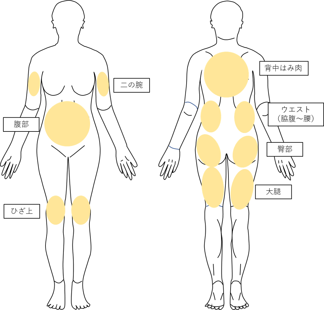 Hifuボディ 医療痩身で部分痩せ 公式 銀座 新宿の美容皮膚科エルクリニック