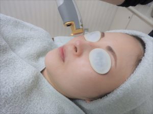 ジェネシス照射