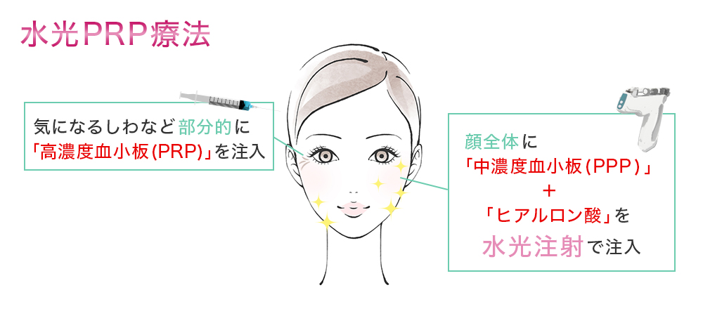 水光PRP療法_エルクリニック