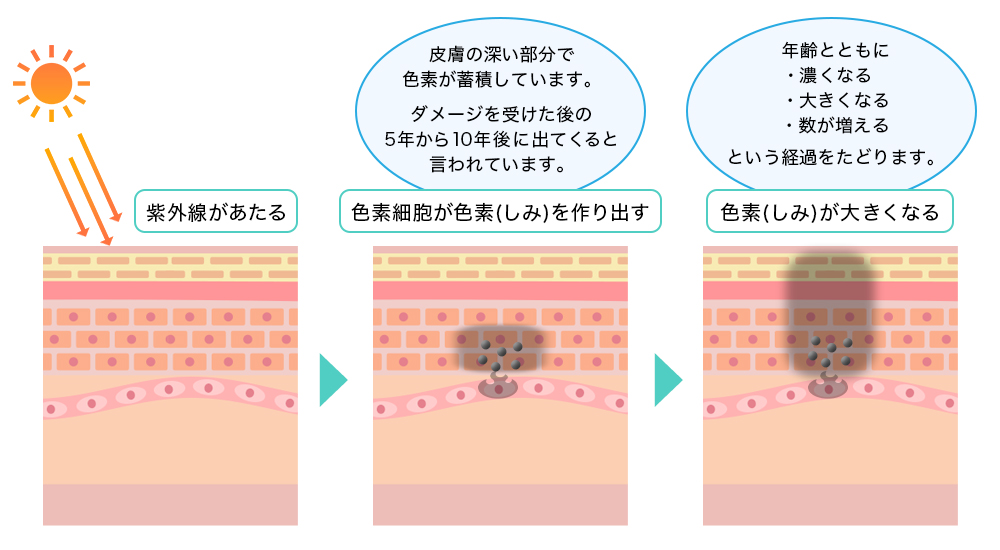 しみの原因から治療まで