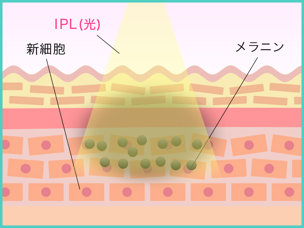 フォトフェイシャル_メカニズム1