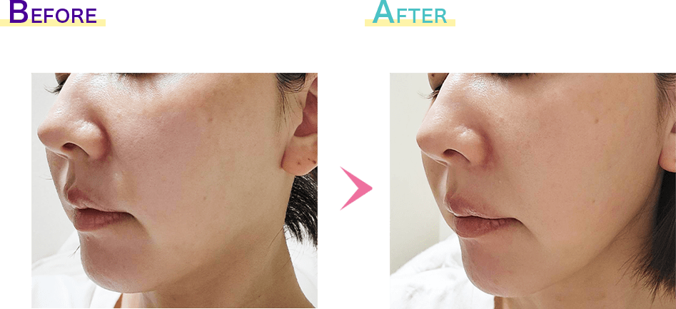 ジェネシス症例1