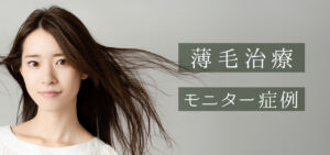 薄毛治療 モニター症例