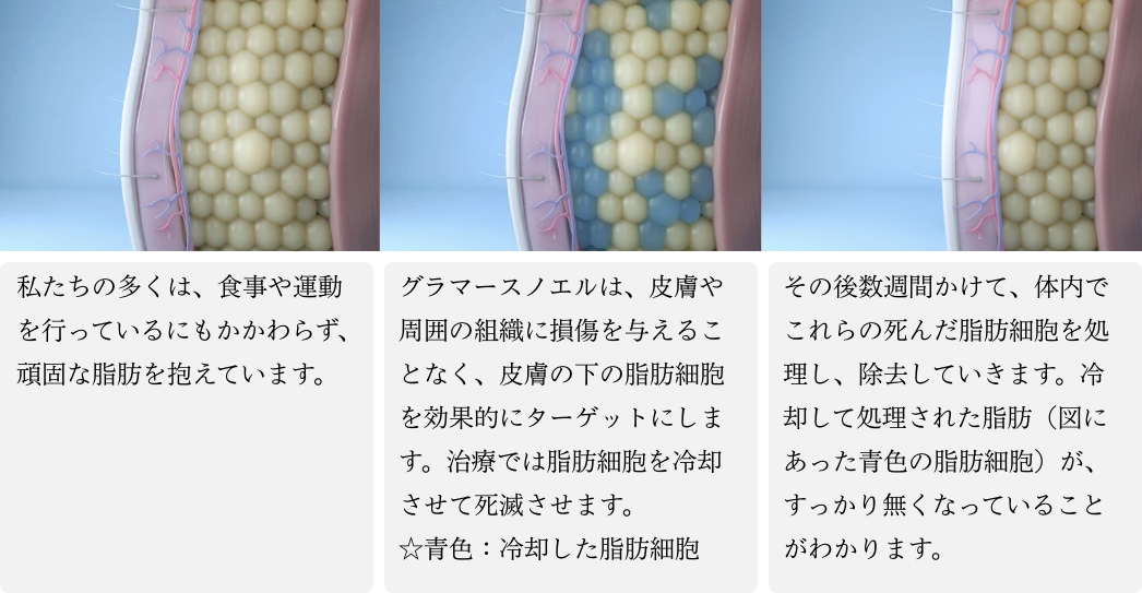 グラマースノエル